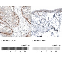 Laminin Antibody, Novus Biologicals:Antibodies:Primary Antibodies